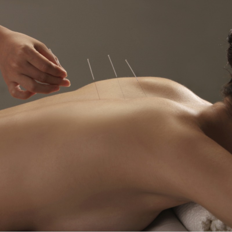 800x800_acupuncture